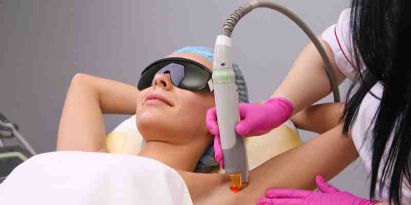 laser hair removal in india